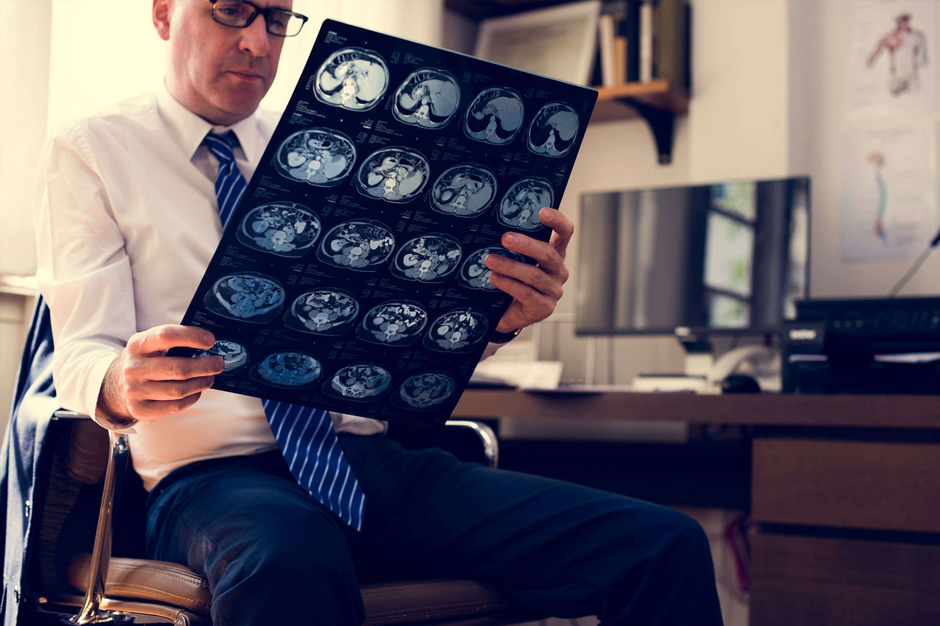 brain-head-injury-solicitors